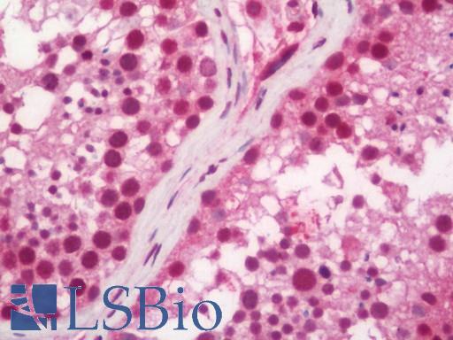Human Testis: Formalin-Fixed, Paraffin-Embedded (FFPE)