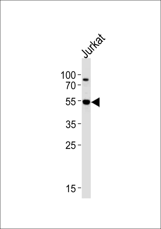 Western blot of lysate from Jurkat cell line,using AKT3 Antibody (Q103). Antibody was diluted at 1:1000 at each lane. A goat anti-rabbit IgG H&L (HRP) at 1:5000 dilution was used as the secondary antibody.Lysate at 35ug per lane.