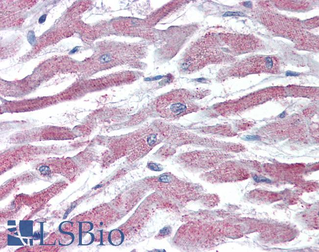 Anti-AKT3 antibody IHC of human heart. Immunohistochemistry of formalin-fixed, paraffin-embedded tissue after heat-induced antigen retrieval. Antibody LS-B3935 concentration 5 ug/ml.