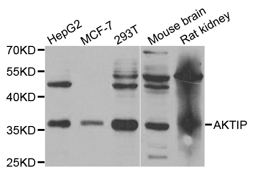 Western blot analysis of extracts of various cell lines, using AKTIP antibody.