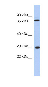 AKTIP antibody LS-C111836 Western blot of Fetal Muscle lysate.