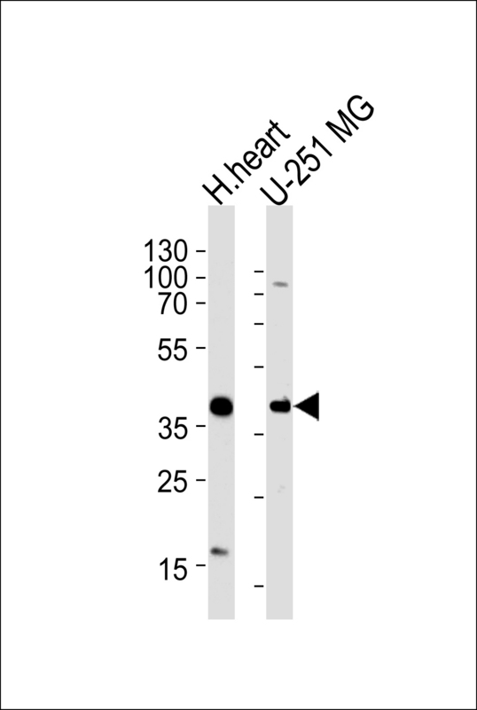 Western blot of lysates from human heart tissue lysate, U-251 MG cell line (from left to right), using AKTIP Antibody. Antibody was diluted at 1:1000 at each lane. A goat anti-rabbit IgG H&L (HRP) at 1:5000 dilution was used as the secondary antibody. Lysates at 35ug per lane.