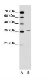 A: Marker, B: Jurkat Cell Lysate