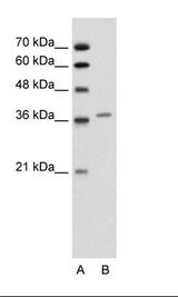 A: Marker, B: Jurkat Cell Lysate