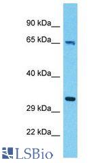 ALAS1 antibody Western Blot of 293T. Antibody dilution: 1 ug/ml.