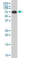 ALAS1 monoclonal antibody (M01), clone 3G10 Western Blot analysis of ALAS1 expression in JAR.