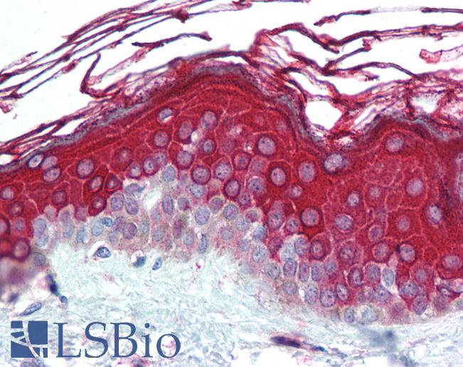 Anti-ALAS1 antibody IHC of human skin. Immunohistochemistry of formalin-fixed, paraffin-embedded tissue after heat-induced antigen retrieval. Antibody LS-B2013 concentration 5 ug/ml.
