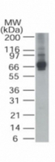 Western blot of ALAS-1 in HepG2 cell lysate using antibody at 1 ug/ml.