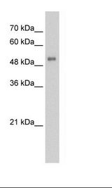 Jurkat Cell Lysate