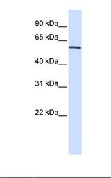 Transfected 293T cell lysate. Antibody concentration: 1.0 ug/ml. Gel concentration: 12%.
