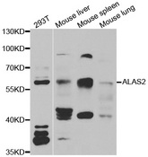 Western blot analysis of extracts of various cell lines, using ALAS2 antibody.