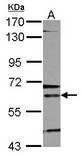 Sample (30 ug of whole cell lysate). A: K562. 7.5% SDS PAGE. ALAS2 antibody diluted at 1:500.