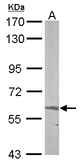 Sample (50 ug of whole cell lysate). A: mouse liver. 7.5% SDS PAGE. ALAS2 antibody diluted at 1:1000.
