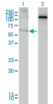 Western Blot analysis of ALAS2 expression in transfected 293T cell line by ALAS2 monoclonal antibody (M01), clone 6C1.Lane 1: ALAS2 transfected lysate(64 KDa).Lane 2: Non-transfected lysate.