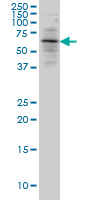 ALAS2 monoclonal antibody (M01), clone 6C1. Western Blot analysis of ALAS2 expression in Raw 264.7.