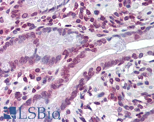 Anti-ABCC8 antibody IHC of human small intestine. Immunohistochemistry of formalin-fixed, paraffin-embedded tissue after heat-induced antigen retrieval. Antibody LS-B5774 concentration 5 ug/ml.