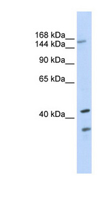 ABCC8 / MRP8 antibody LS-B5774 Western blot of 293T cell lysate.