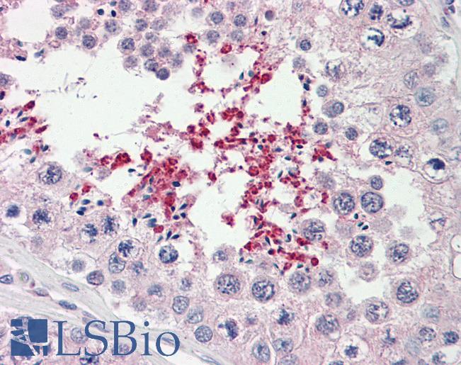 Human Testis: Formalin-Fixed, Paraffin-Embedded (FFPE)