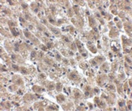 Immunohistochemistry of Albumin in human liver tissue with Albumin antibody at 2.5 ug/ml.