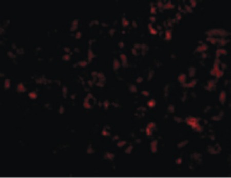 Immunofluorescence of Albumin in Human Liver cells with Albumin antibody at 20 ug/ml.