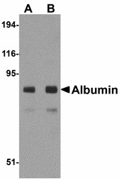 Western blot of Albumin in mouse liver tissue lysate with Albumin antibody at (A) 1 and (B) 2 ug/ml. Below: Immunohistochemistry of Albumin in human liver tissue with Albumin antibody at 2.5 ug/ml.