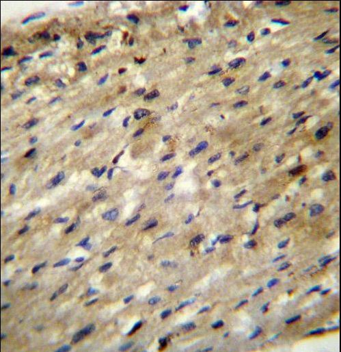 ABCD2 Antibody immunohistochemistry of formalin-fixed and paraffin-embedded human heart tissue followed by peroxidase-conjugated secondary antibody and DAB staining.