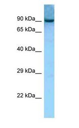 AACS antibody Western Blot of Mouse Thymus.