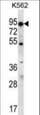 ABCD2 Antibody western blot of K562 cell line lysates (35 ug/lane). The ABCD2 antibody detected the ABCD2 protein (arrow).