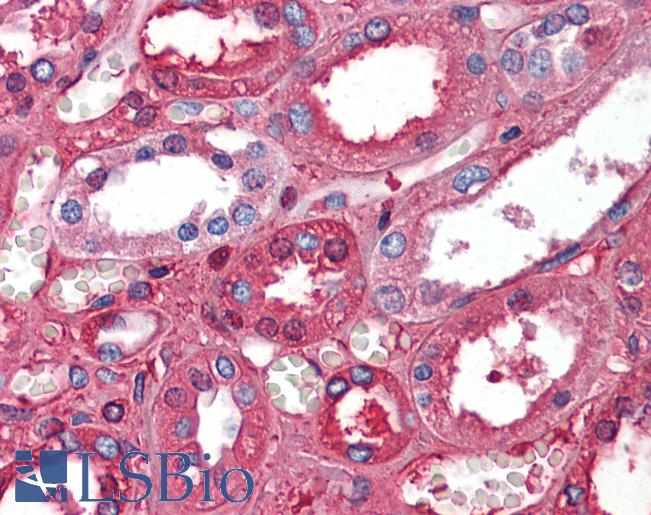 Anti-Serum Albumin antibody IHC of human kidney. Immunohistochemistry of formalin-fixed, paraffin-embedded tissue after heat-induced antigen retrieval. Antibody LS-B5730 concentration 5 ug/ml.