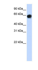 ALB / Albumin antibody LS-B5731 Western blot of Fetal Brain lysate.