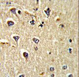 Formalin-fixed and paraffin-embedded human brain tissue reacted with CD166 Antibody , which was peroxidase-conjugated to the secondary antibody, followed by DAB staining. This data demonstrates the use of this antibody for immunohistochemistry; clinical relevance has not been evaluated.