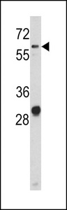 Western blot of CD166 antibody in NCI-H460 cell line lysates (35 ug/lane). CD166 (arrow) was detected using the purified antibody.