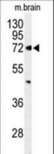 Western blot of ABCD2 Antibody in mouse brain tissue lysates (35 ug/lane). ABCD2 (arrow) was detected using the purified antibody.