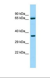 Western blot of Human ACHN. ALDH16A1 antibody dilution 1.0 ug/ml.