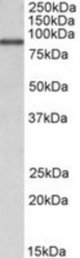 ALDH18A1 antibody (1 ug/ml) staining of MCF7 lysate (35 ug protein/ml in RIPA buffer). Primary incubation was 1 hour. Detected by chemiluminescence.