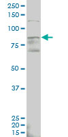 ALDH18A1 monoclonal antibody (M01), clone 2B5 Western Blot analysis of ALDH18A1 expression in MCF-7.
