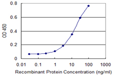Detection limit for recombinant GST tagged ALDH18A1 is 0.3 ng/ml as a capture antibody.