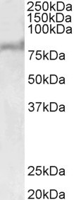 ABCD2 antibody (1 ug/ml) staining of Human Liver lysate (35 ug protein in RIPA buffer). Primary incubation was 1 hour. Detected by chemiluminescence.