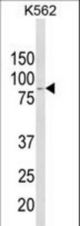 Western blot of ALDH18A1 Antibody in K562 cell line lysates (35 ug/lane). ALDH18A1 (arrow) was detected using the purified antibody.
