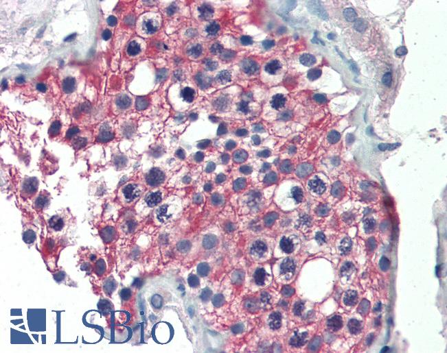 Anti-ALDH1A1 antibody IHC of human testis. Immunohistochemistry of formalin-fixed, paraffin-embedded tissue after heat-induced antigen retrieval. Antibody LS-B2497 concentration 5 ug/ml.