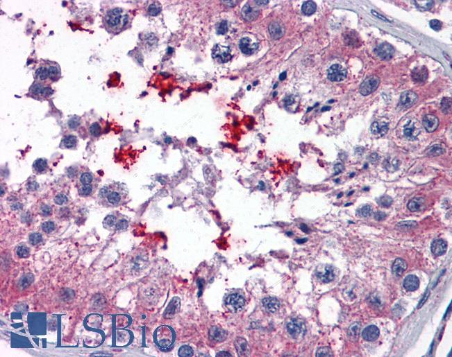 Anti-ABCD4 antibody IHC of human testis. Immunohistochemistry of formalin-fixed, paraffin-embedded tissue after heat-induced antigen retrieval. Antibody LS-B4375 concentration 3.75 ug/ml.
