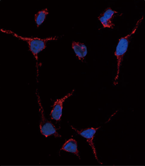 Immunofluorescence of anti-ALDH1A1 Antibody in HeLa cells. 0.025 mg/ml primary antibody was followed by Alexa-Fluor-546-conjugated donkey anti-rabbit lgG (H+L). Alexa-Fluor-546 emits orange fluorescence. Blue counterstaining is DAPI.