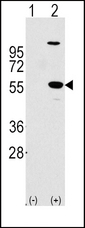 Western blot of ALDH1A1 (arrow) using rabbit polyclonal ALDH1A1 Antibody. 293 cell lysates (2 ug/lane) either nontransfected (Lane 1) or transiently transfected with the ALDH1A1 gene (Lane 2) (Origene Technologies).