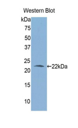 Western blot of recombinant ALDH1A3.