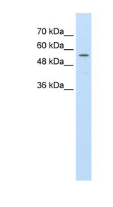 ABCD4 antibody LS-C40417 Western blot of HepG2 cell lysate.