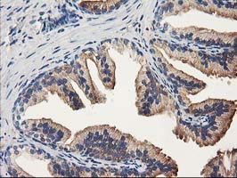 IHC of paraffin-embedded Human prostate tissue using anti-ALDH1A3 mouse monoclonal antibody.