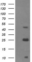 Negative control E. coli lysate (Left lane) or E. coli lysate containing recombinant protein fragment for human ALDH1A3 (NP_000648) gene (the fusion of amino acids 1-100 and 413-512) (Right lane). Equivalent amounts (5 ug per lane) were separated by SDS-PAGE and then immunoblotted with anti-ALDH1A3. .