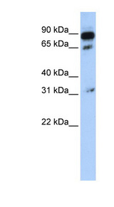 ABCD4 antibody LS-C102046 Western blot of 721_B cell lysate.
