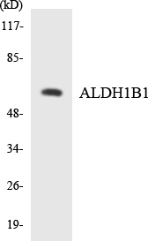 Western blot of the lysates from HepG2 cells using ALDH1B1 antibody.