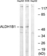 Western blot of extracts from HepG2/COS cells, using ALDH1B1 Antibody. The lane on the right is treated with the synthesized peptide.